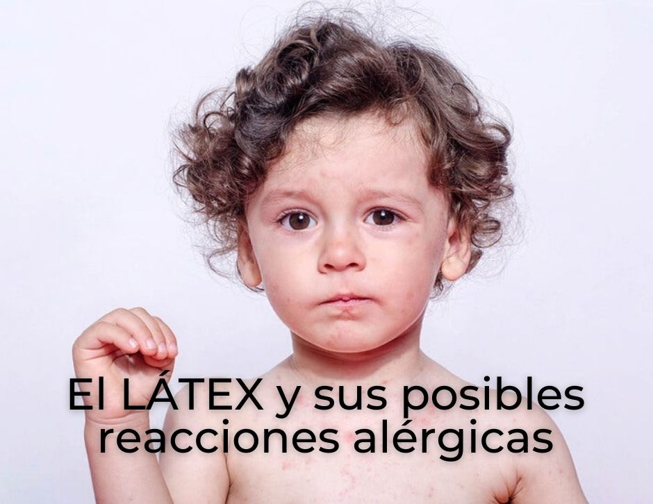 El LÁTEX Y SUS POSIBLES REACCIONES ALÉRGICAS