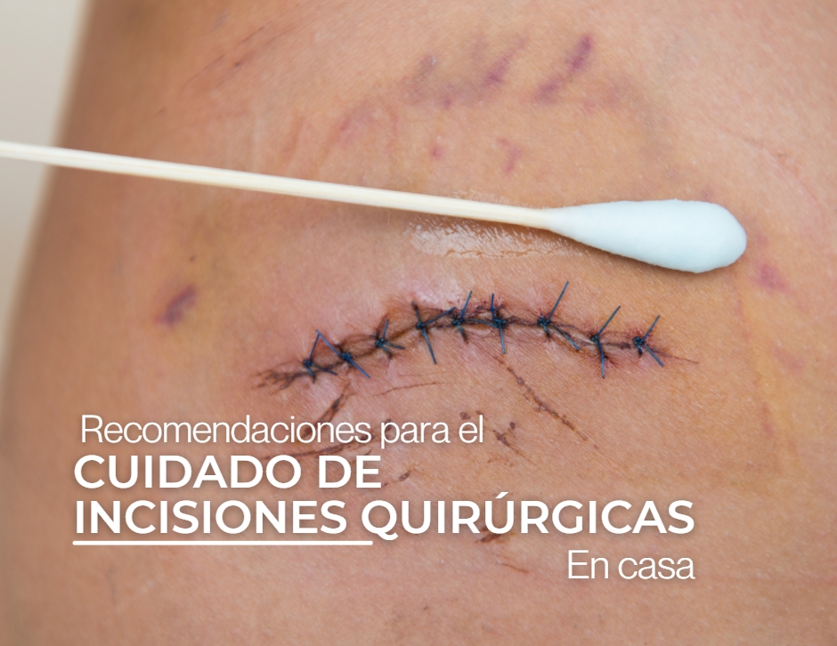 Recomendaciones para el cuidado de incisiones quirúrgicas en casa